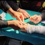 A Termoli i vigili del fuoco rimuovono due anelli bloccati sulla mano gonfia di una donna al pronto soccorso