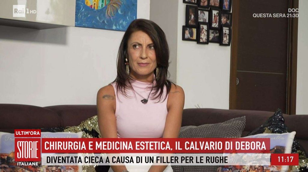 Debora_cieca_a_un_occhio_dopo_
