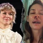 Evangeline lilly svenuta in spiaggia con ferite al volto durante una gita al mare