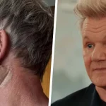 Gordon Ramsay si opera per carcinoma basocellulare e lancia un appello sulla crema solare